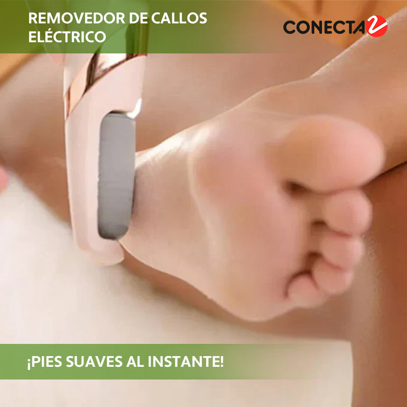 Removedor de callos eléctrico